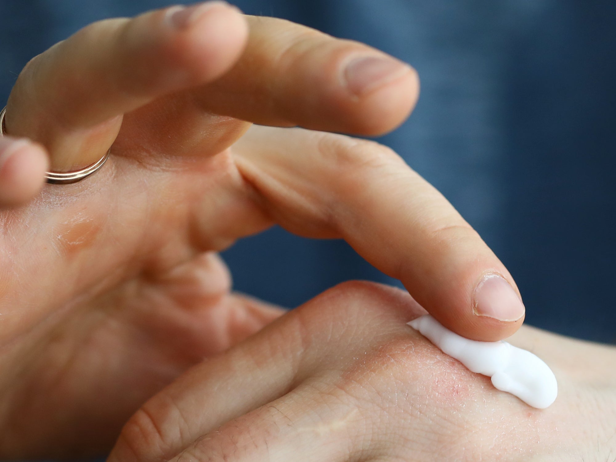 Why My Face Burns When Applying Moisturizer: Causes & Solutions