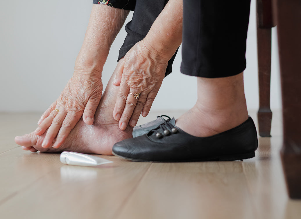 What Is The Best Treatment For Stasis Dermatitis? Balmonds