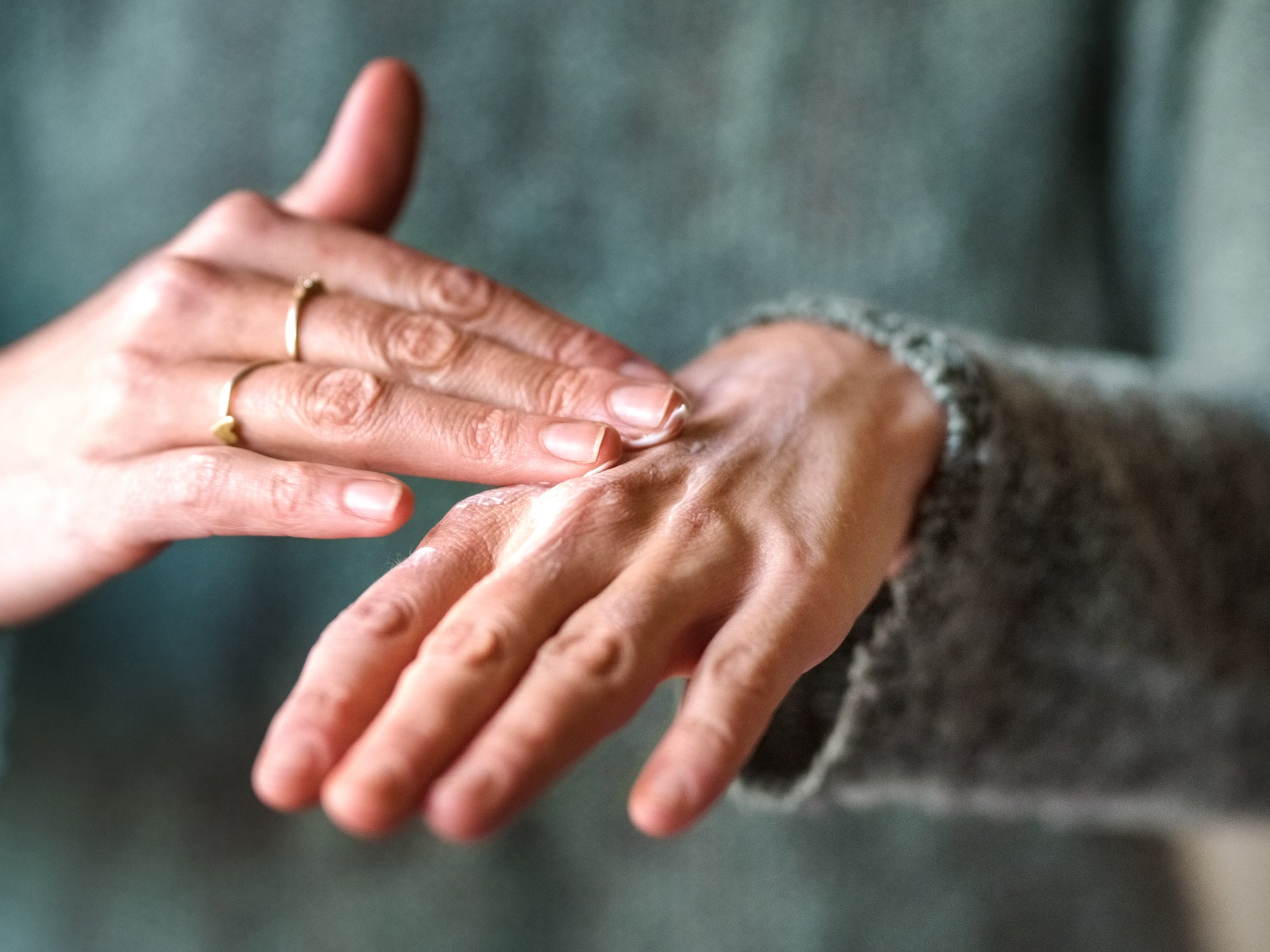 What’s The Best Natural Moisturiser For Chemo Rash?