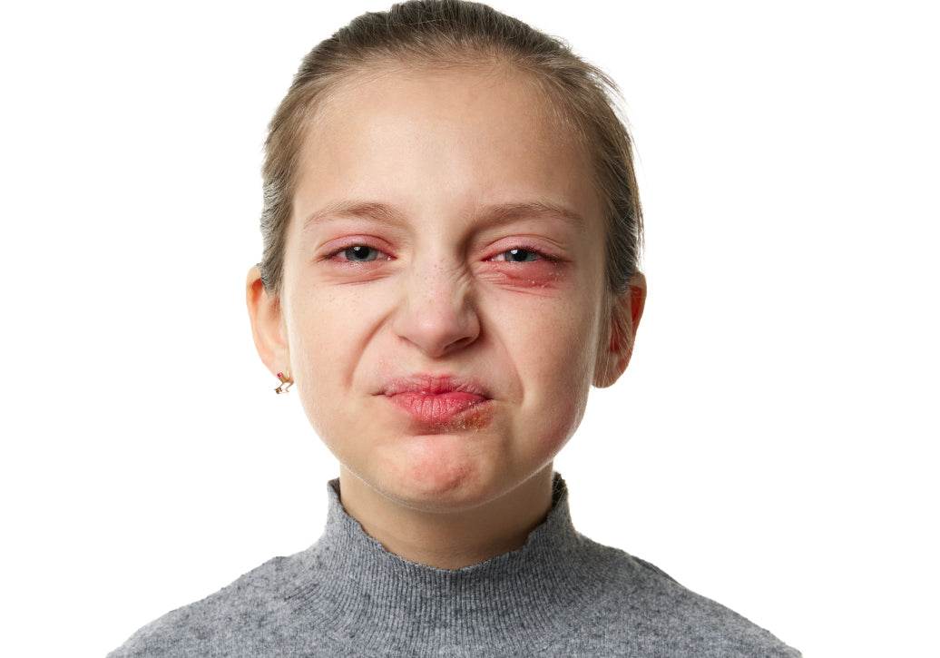 What Causes Dermatitis Around Eyes?