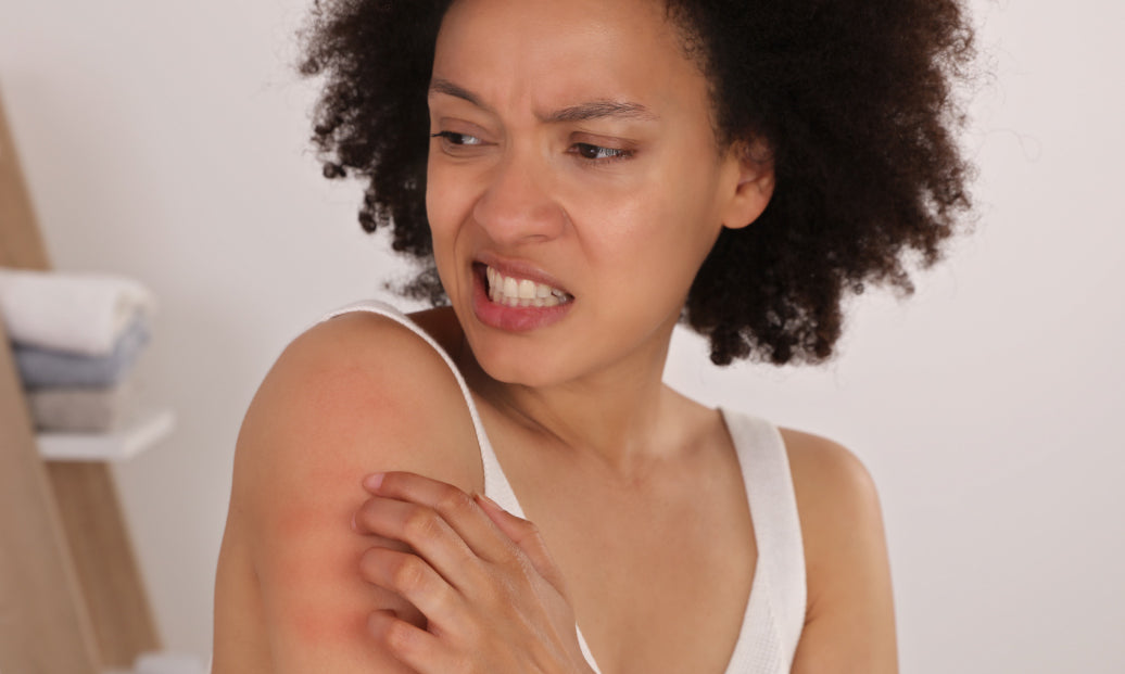 Is Eczema A Sign Of A Weak Immune System?