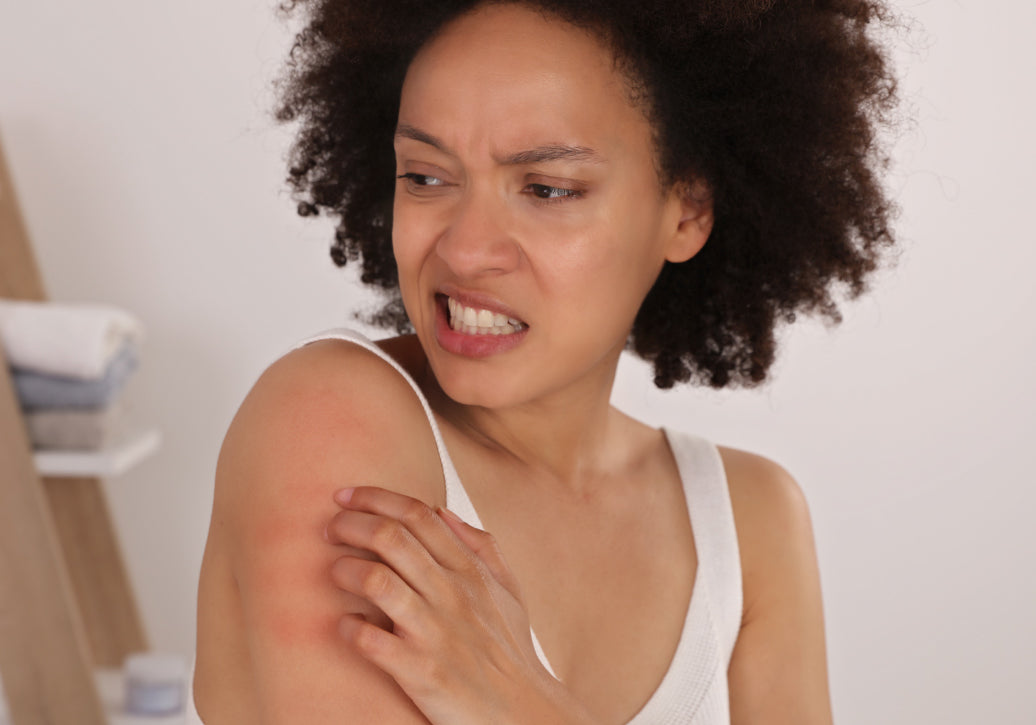 Is Eczema A Sign Of A Weak Immune System?