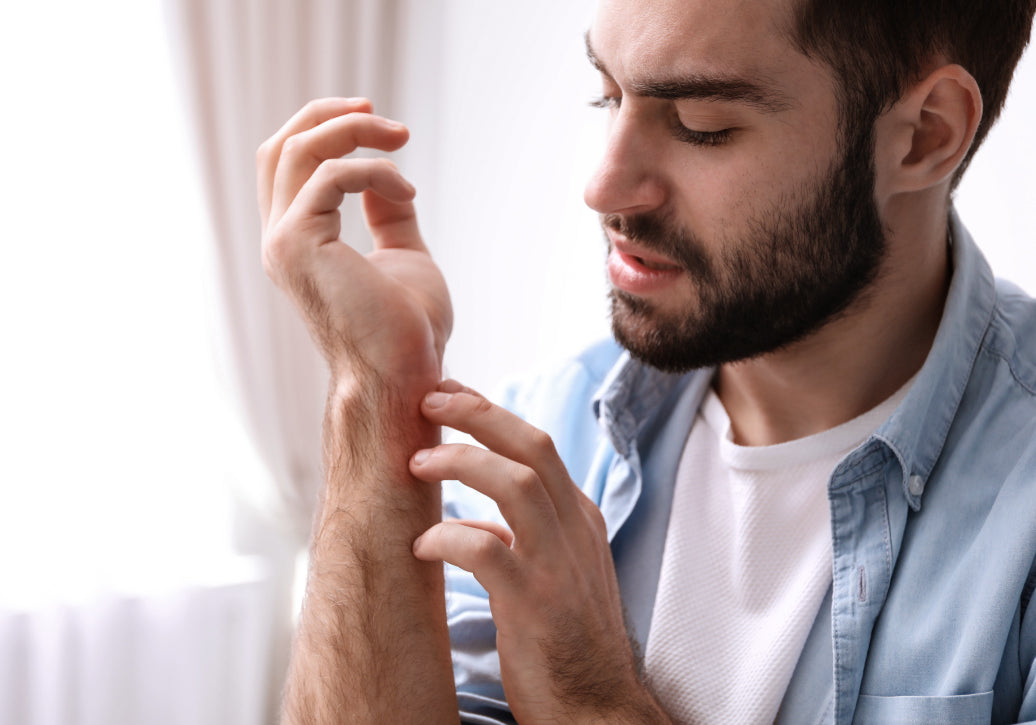 What Causes Eczema In Adults?