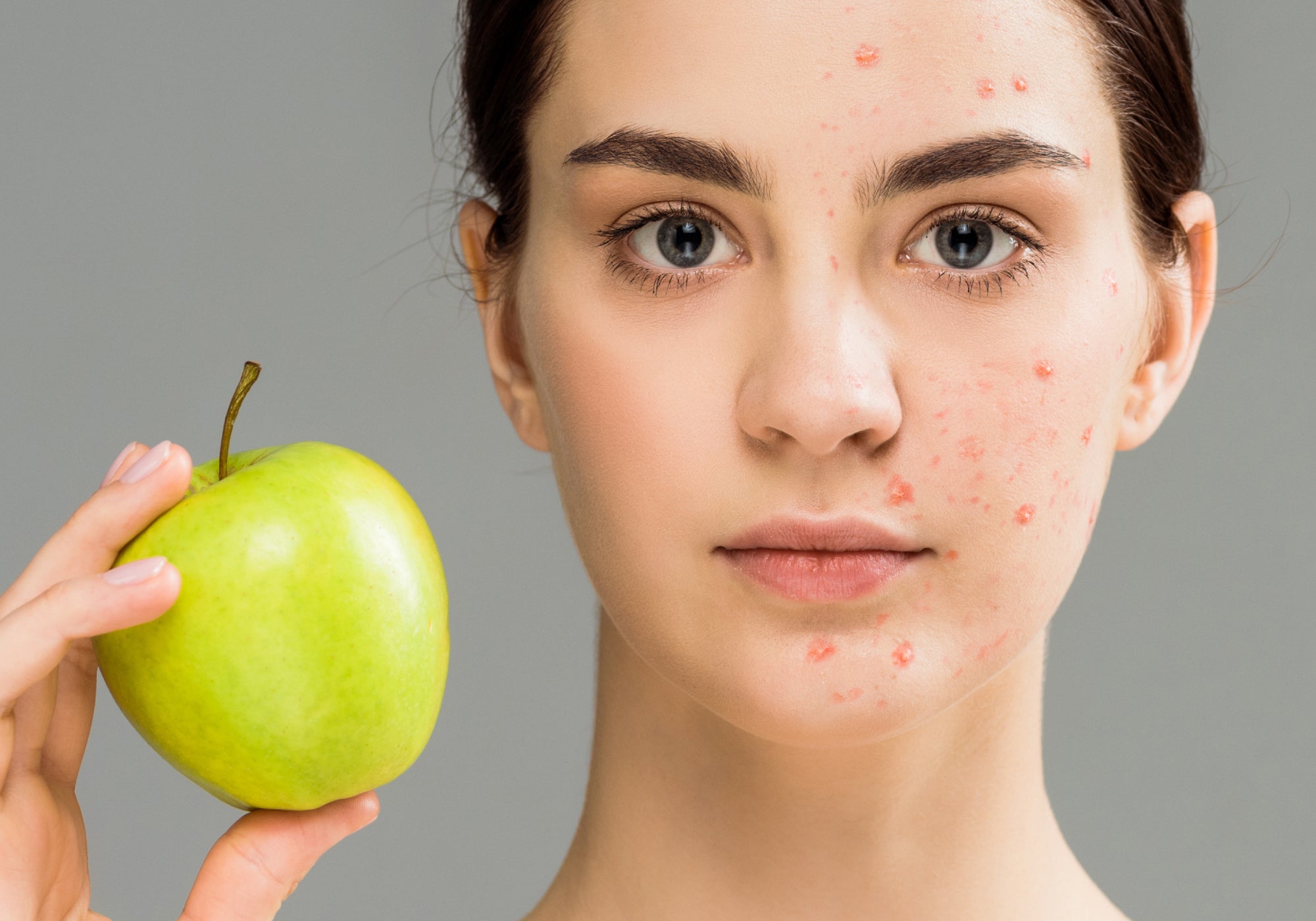 How Long Does It Take For Diet To Affect Skin?