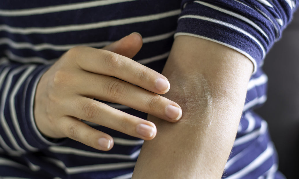 Rubbing cream into arm