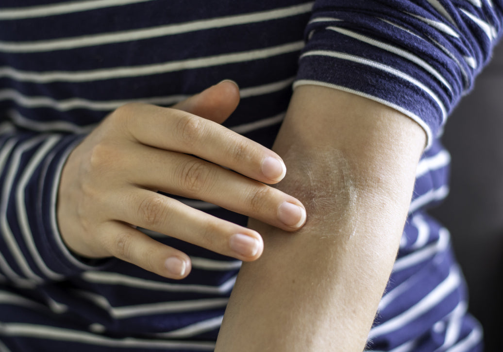 Rubbing cream into arm