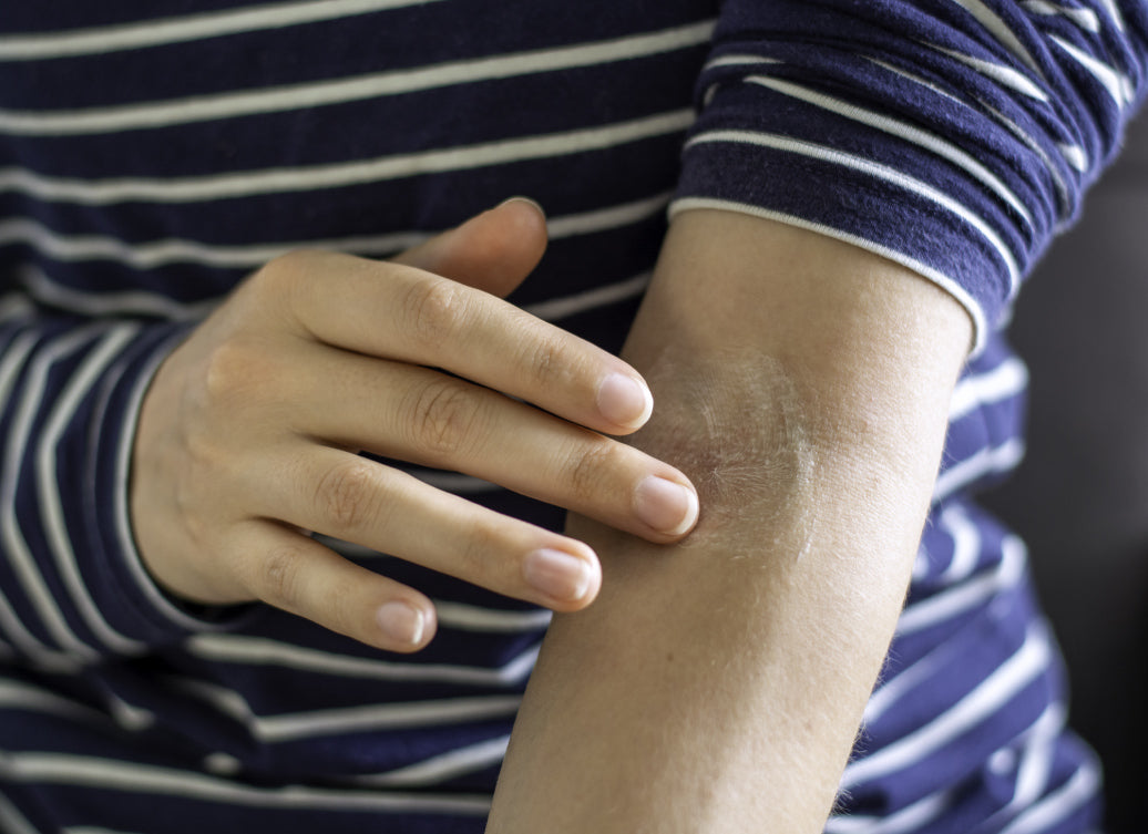 Rubbing cream into arm