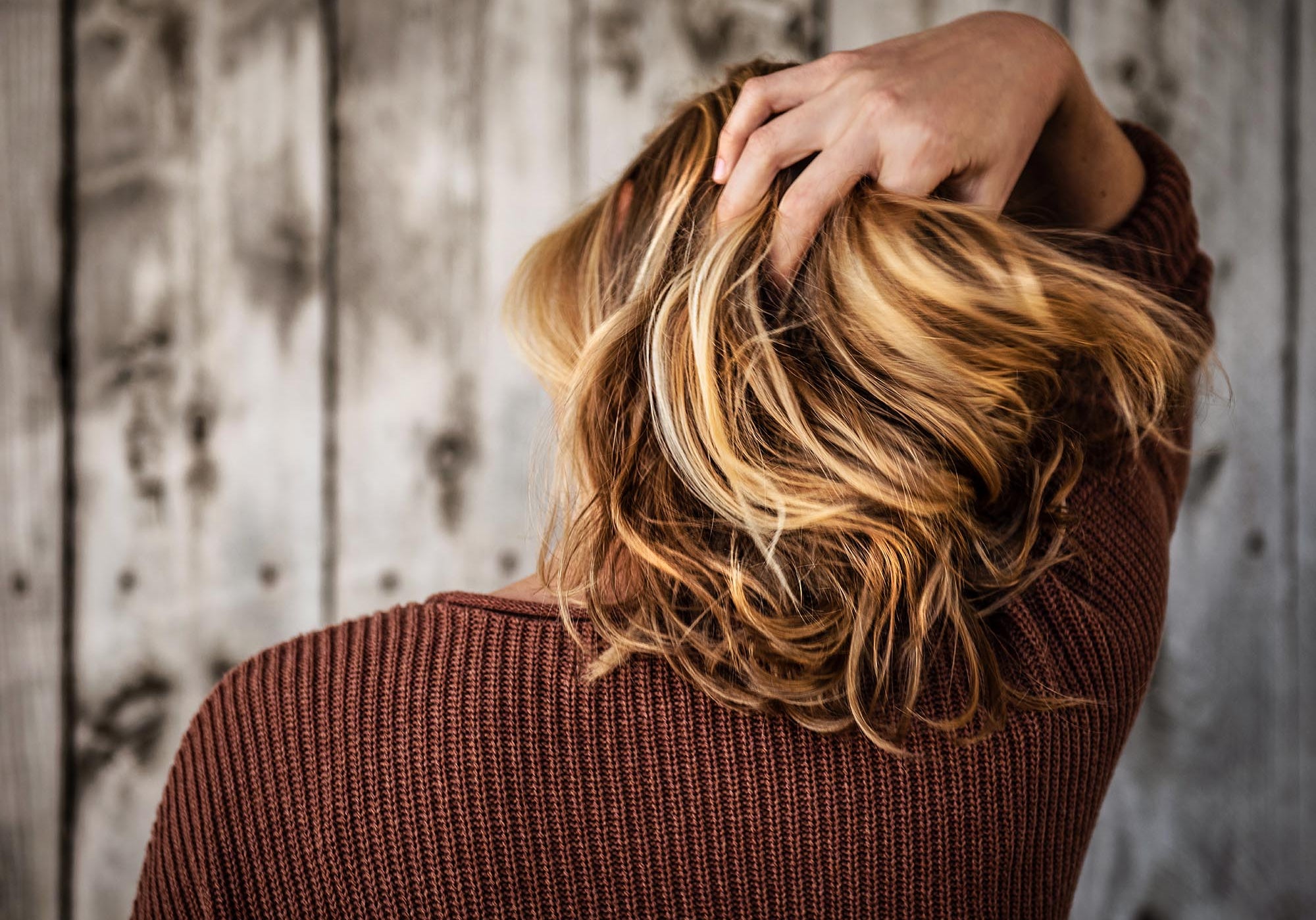 How To Treat Scalp Psoriasis Naturally