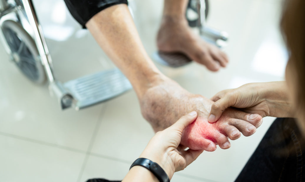 a foot being examined for dermatitis