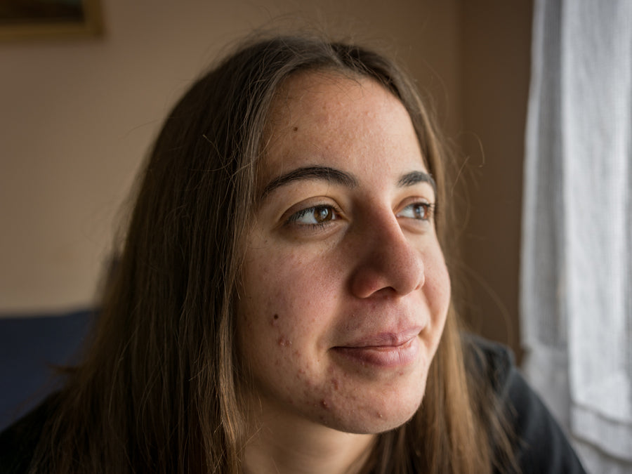 Almonds Skin Rash What Do Chemo Rashes Look Like? – Balmonds
