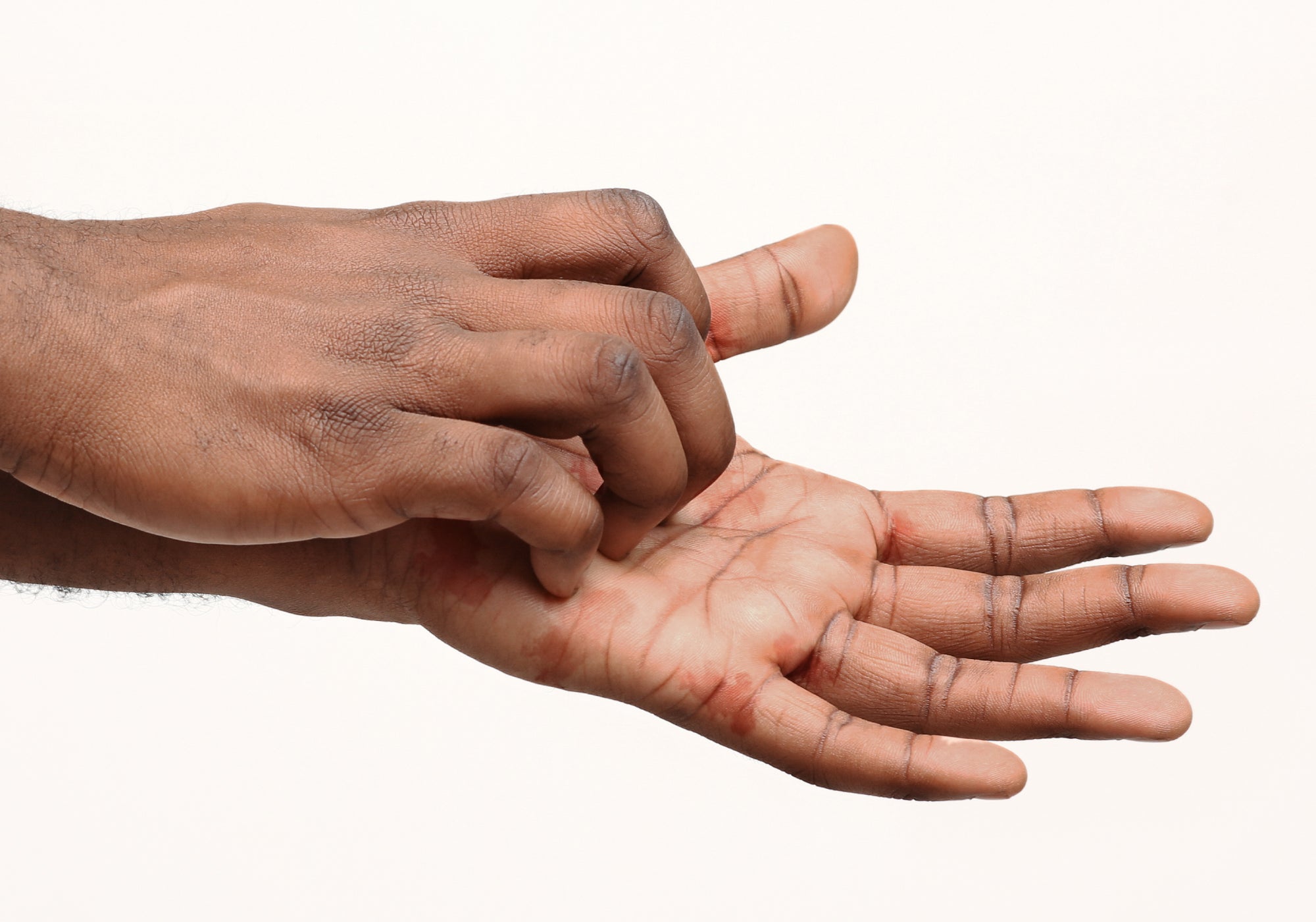 Best Hand Cream For Cracked, Red-Raw, Sore Hands