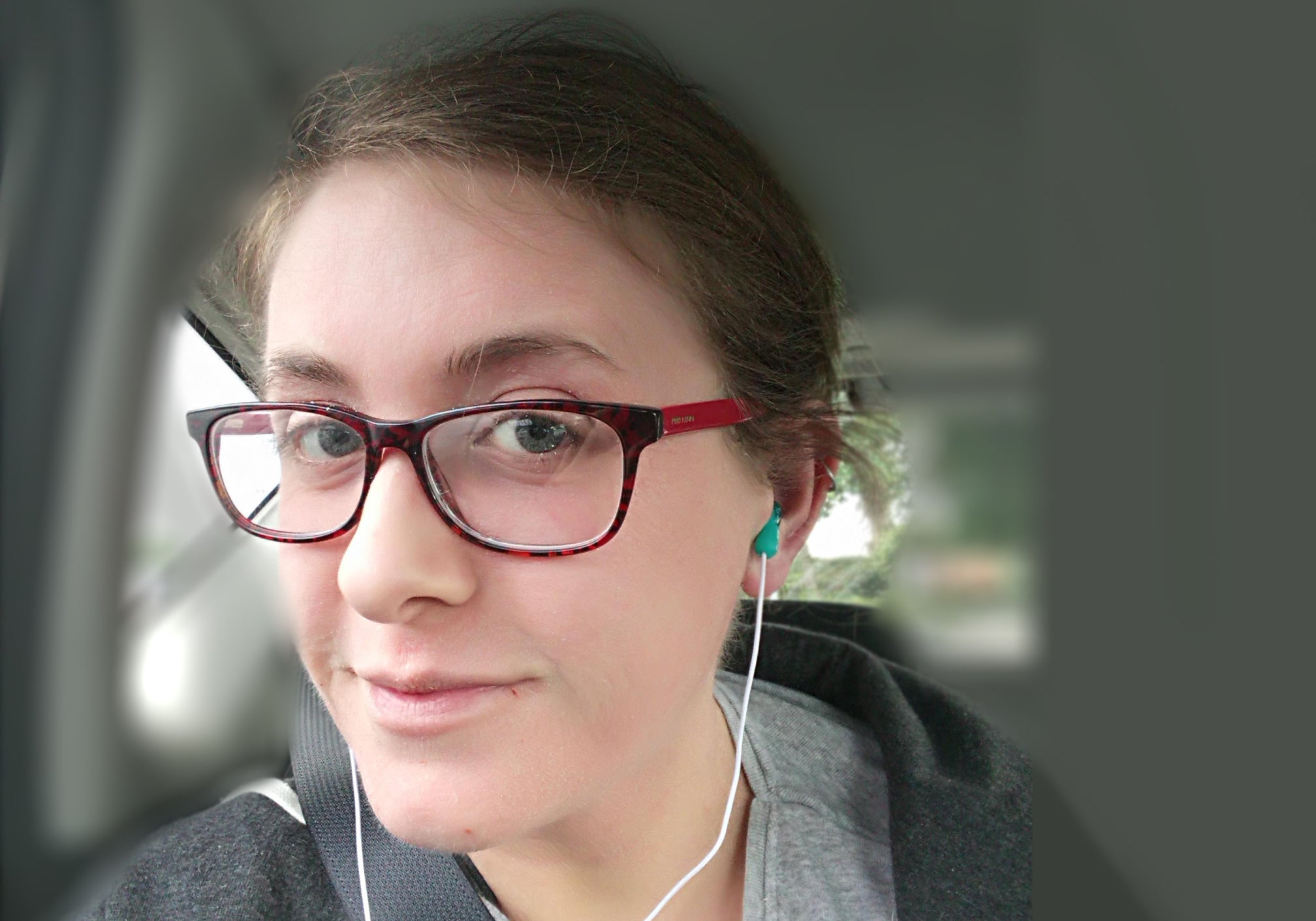 The Brutal Truth: Topical Steroid Withdrawal - Emilie's Story
