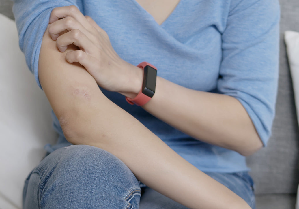 Itching a rash on the upper arm