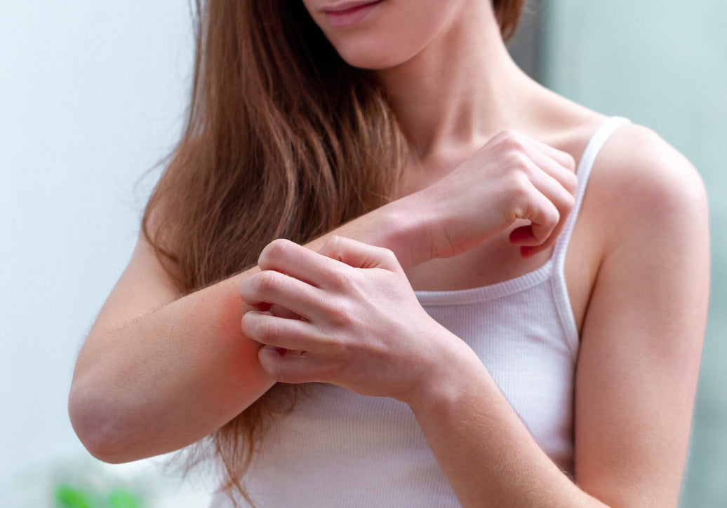 scratching polymorphic light eruption on arm