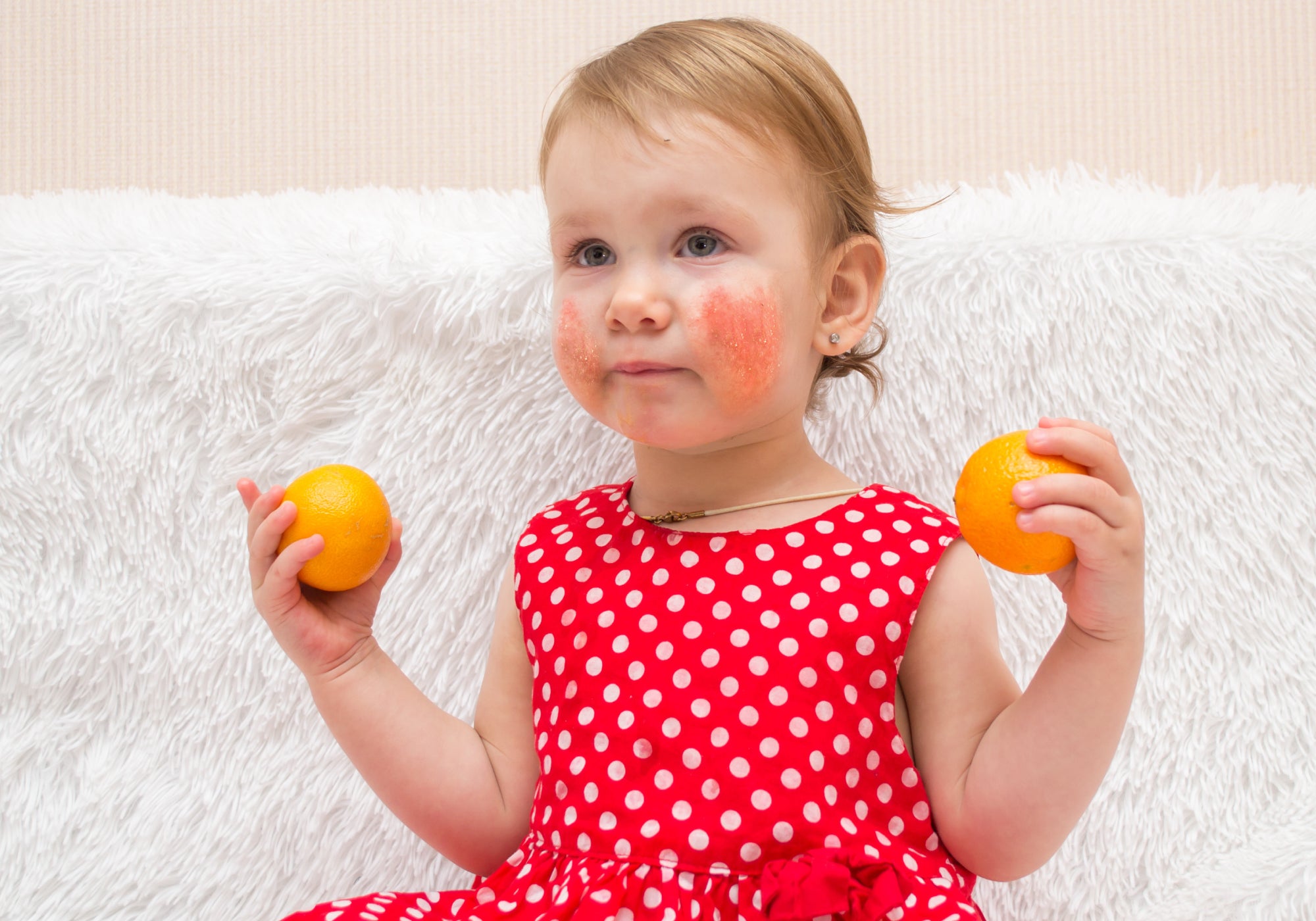 Baby with eczema holding satsumas