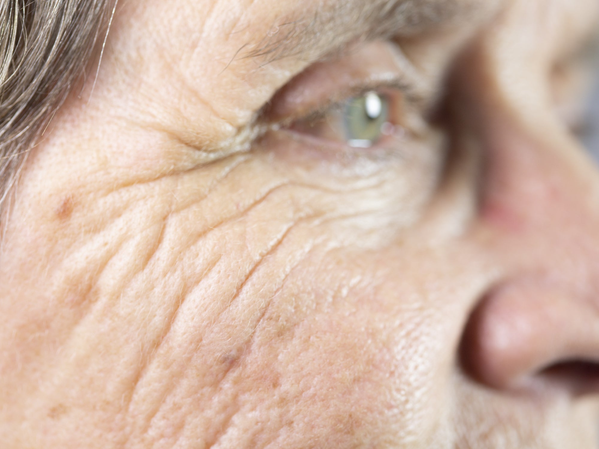 Weeping Wounds: The Truth About Over The Counter Treatments - vcxxawb