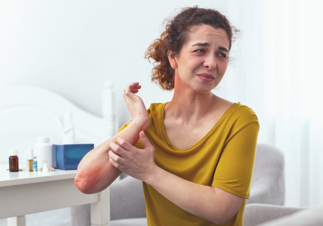 Person with long covid itching arm