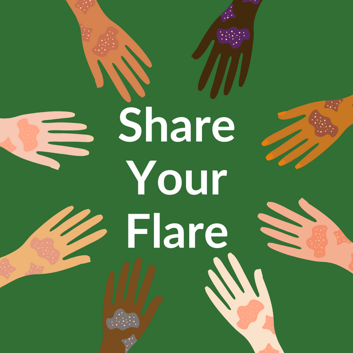 #ShareYourFlare Campaign