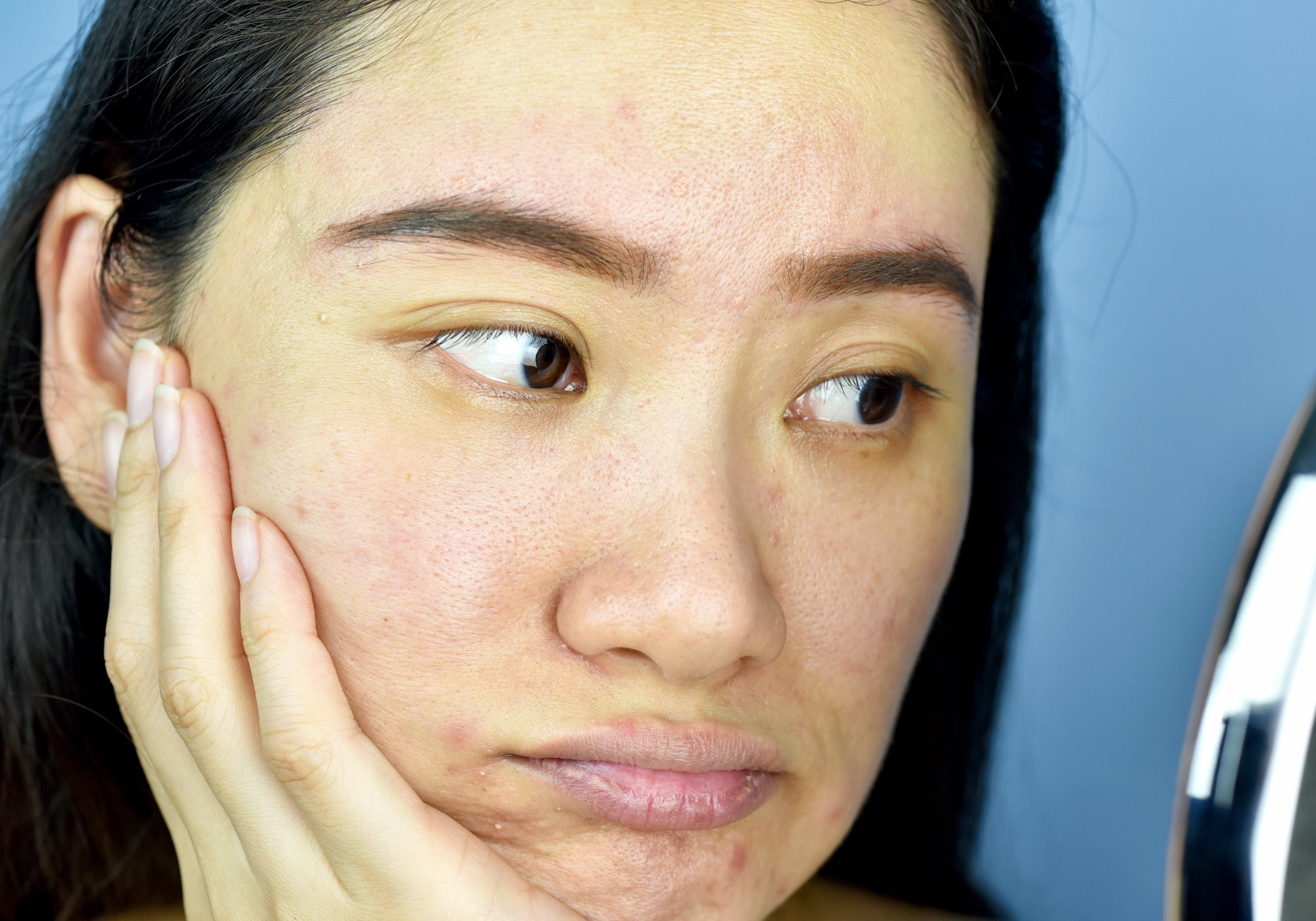 Why COVID-19 Lockdown Is Drying Your Skin Out
