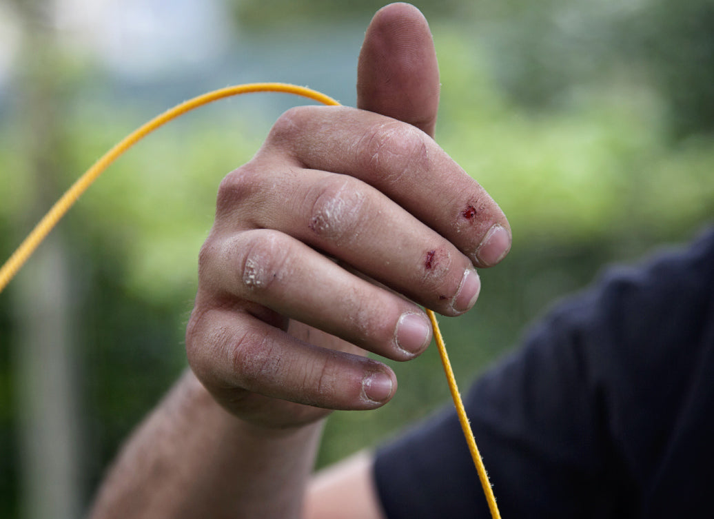 A climber holding some thin rope, showing grazes and marks on hands