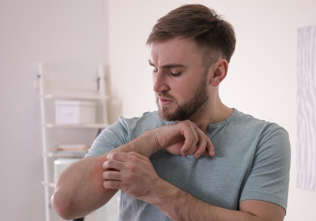 Scratching PMLE on arm