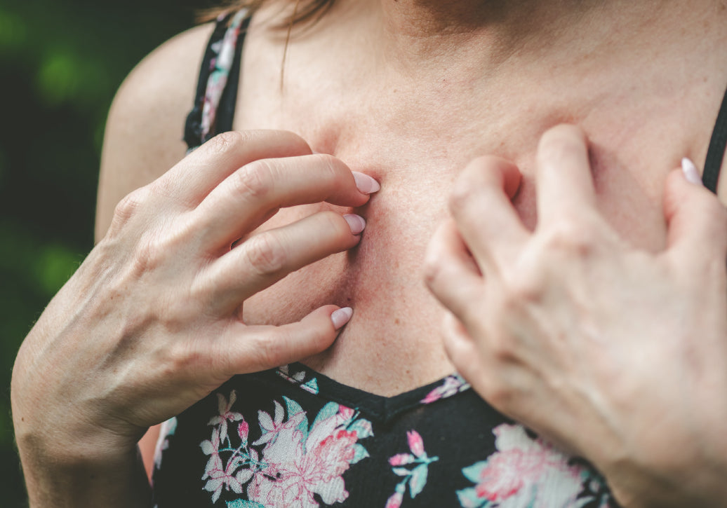 Scratching eczema on chest