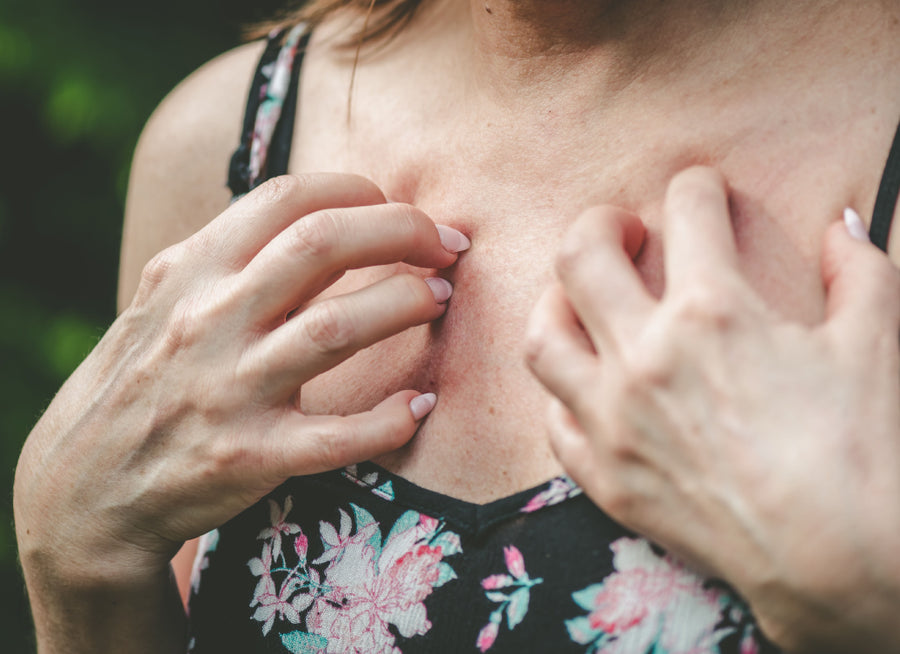Scratching eczema on chest