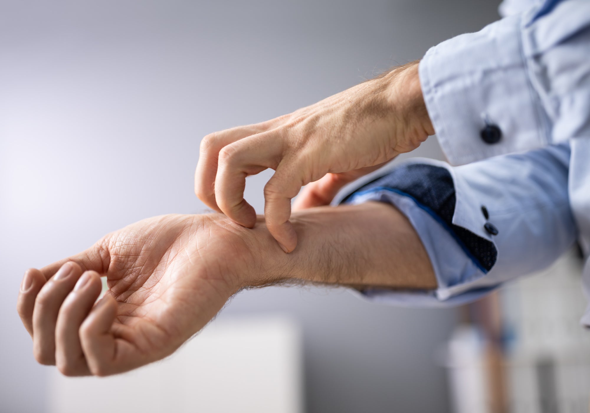 Scratching the wrist