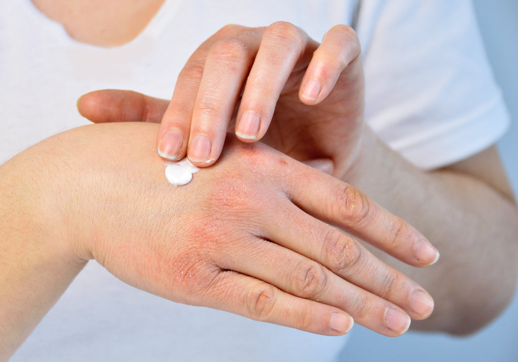 applying cream to back of hand