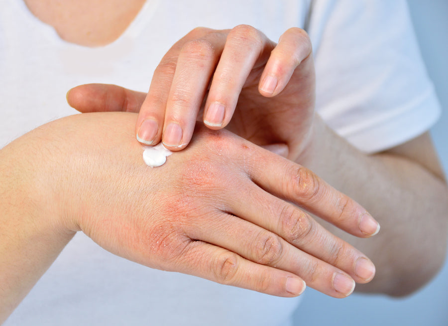 applying cream to back of hand