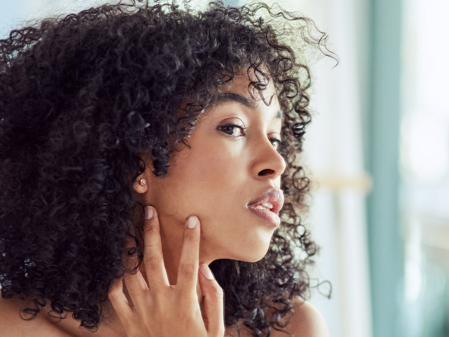 How To Tell The Difference Between Acne And Eczema