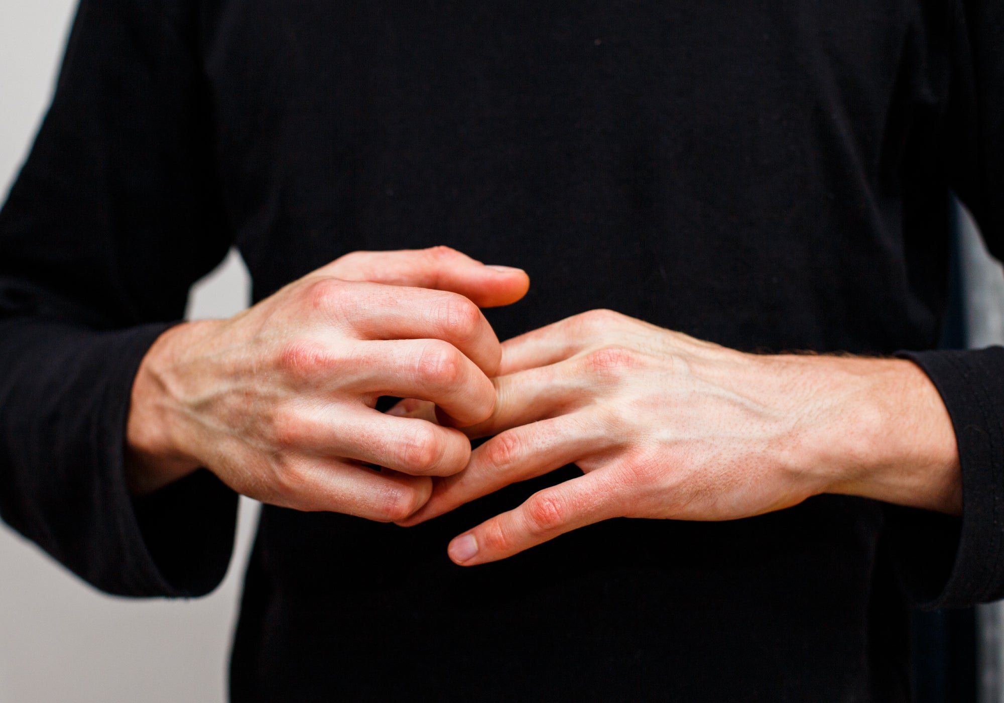 How To Soothe An Allergic Reaction To Hand Sanitiser