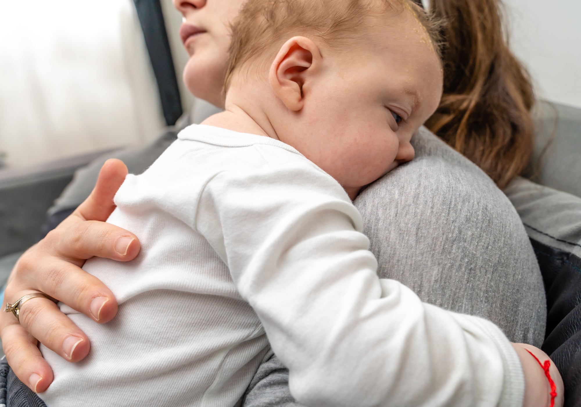 How Do I Know If My Baby Has Topical Steroid Withdrawal Syndrome?