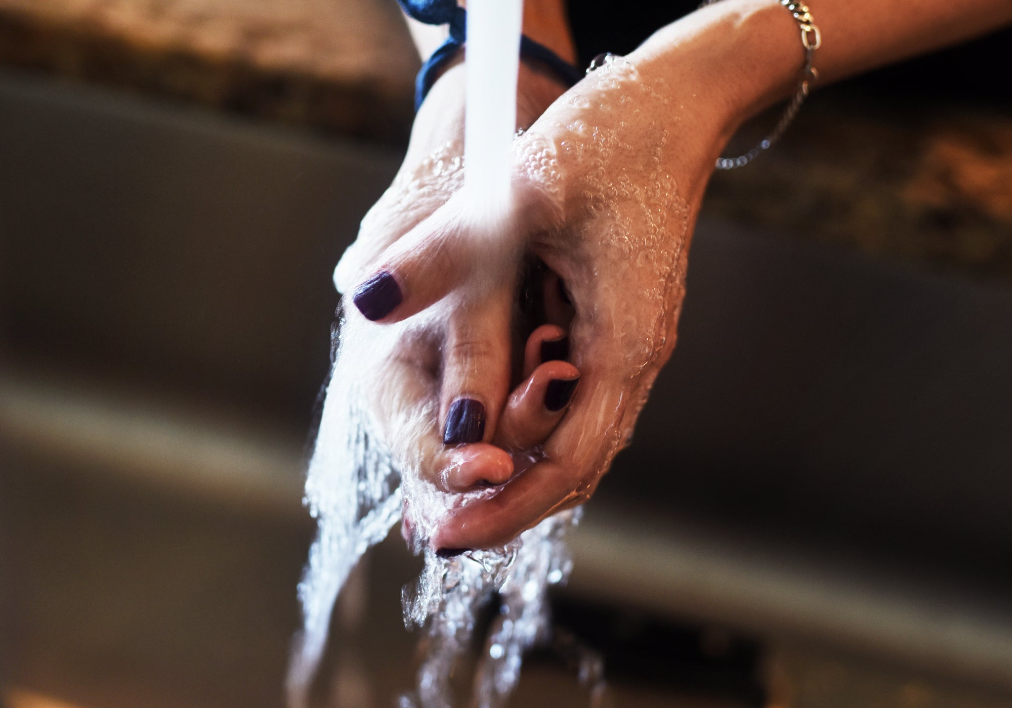How Do I Stop My Hands From Itching After Washing Them?