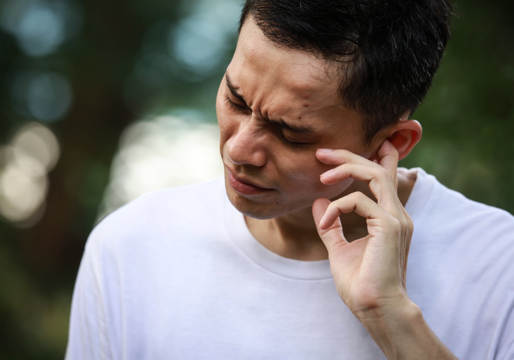 How To Apply Cream To Eczema In The Ears