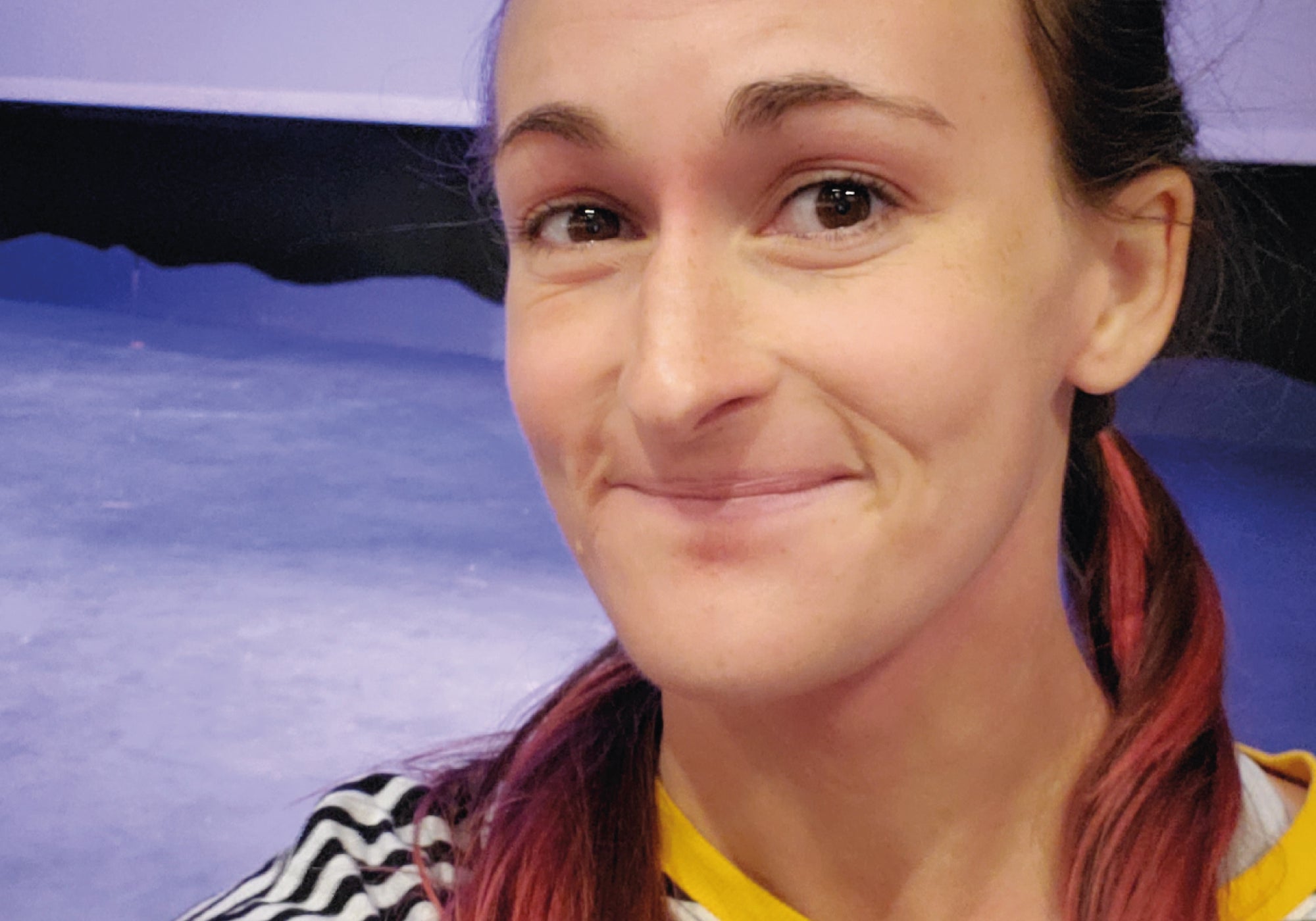 Briana Banos: Topical Steriod Withdrawal Five Years On
