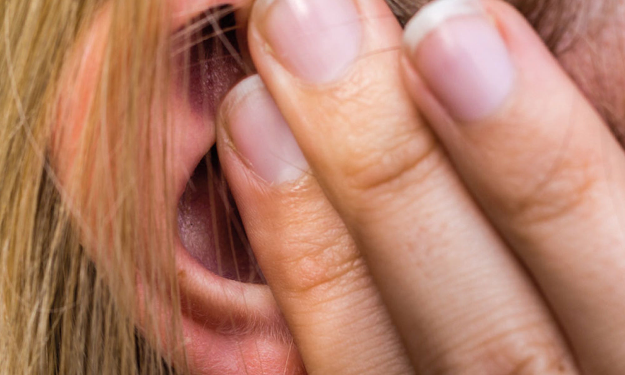 How To Treat Ear Psoriasis