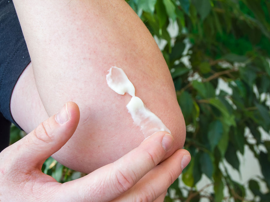 5 Toxic Ingredients To Avoid In Eczema Creams