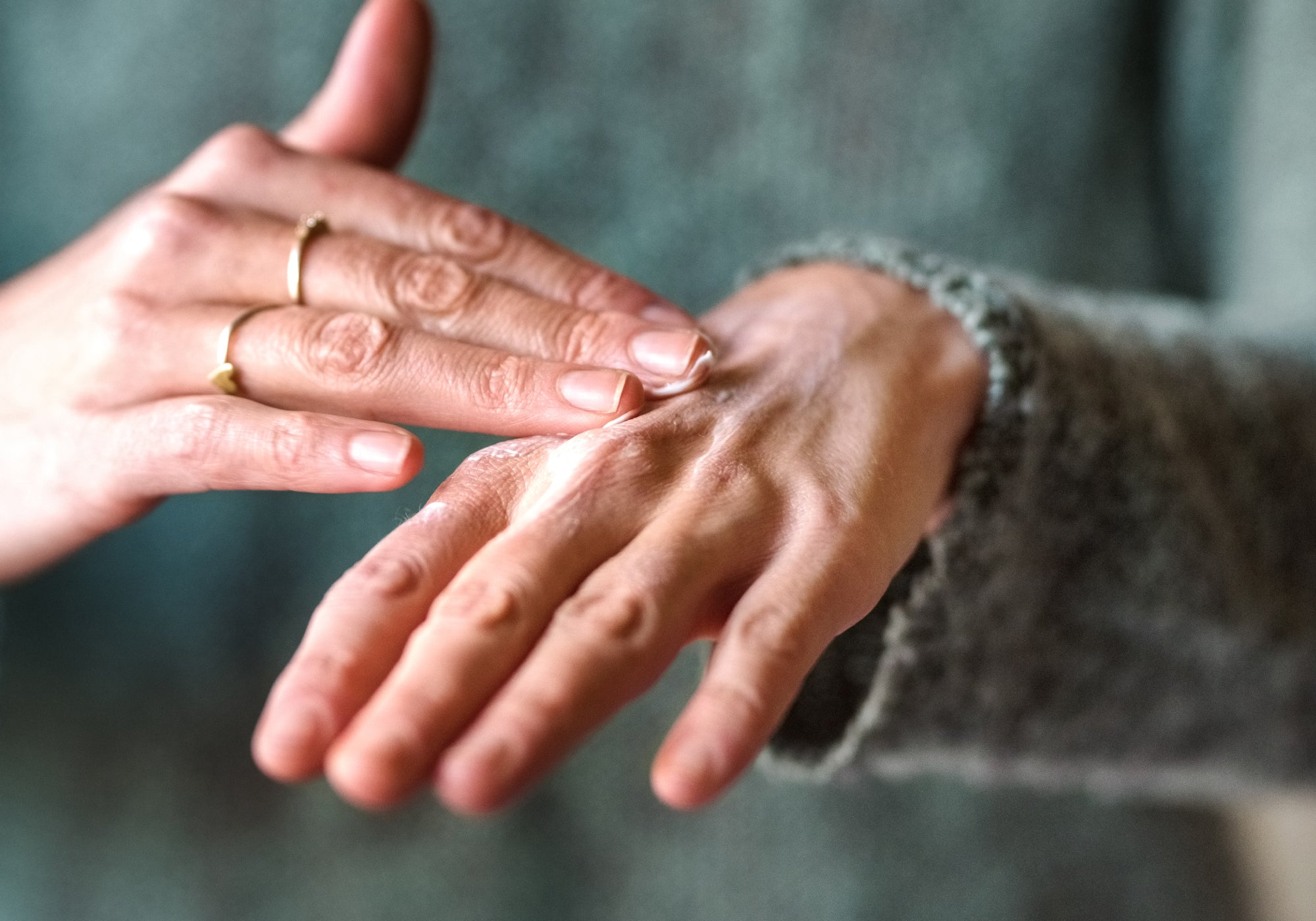 5 Top Tips To Manage Chronically Dry, Cracked Hands