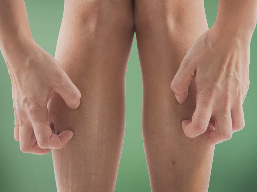 6 Common Causes Of Itchy Lower Legs