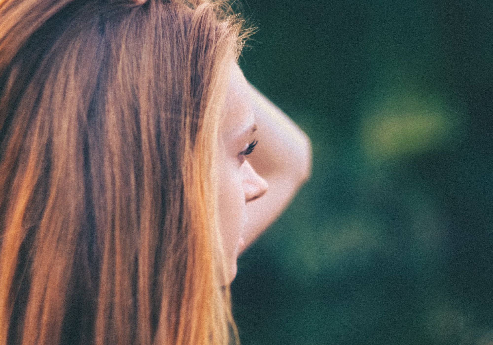The Scars Left Behind: Coping With Life After Topical Steroid Withdrawl (TSW)