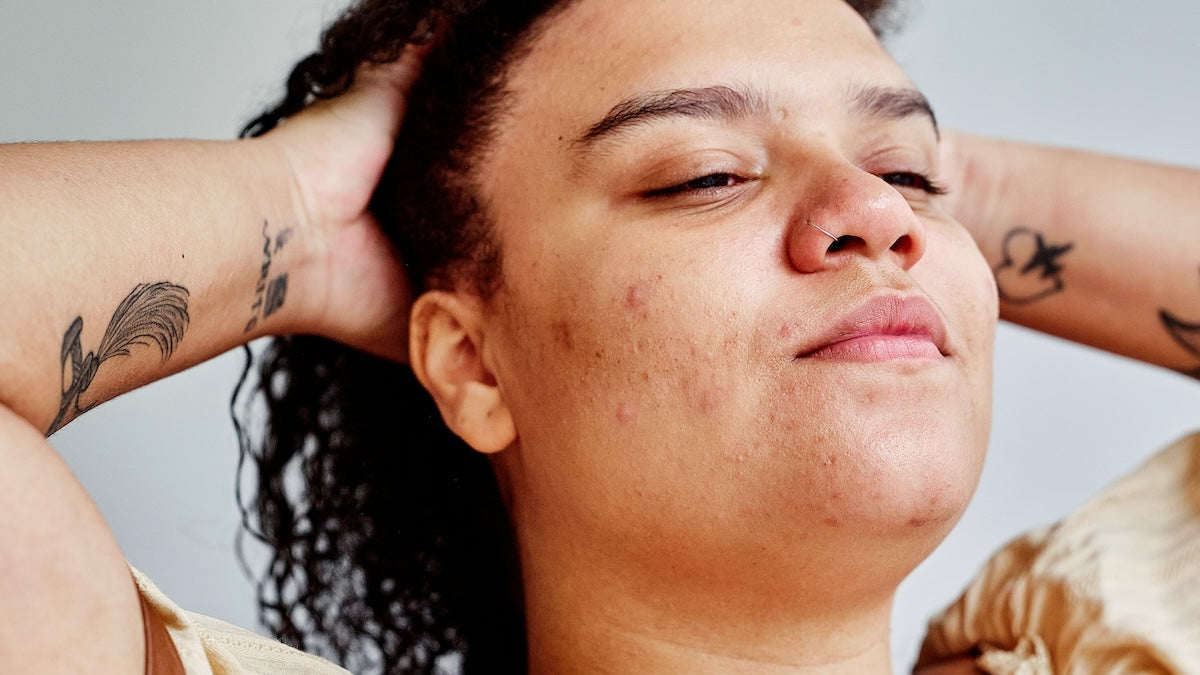 woman with natural skin reflecting impacts of stress and the mind body connection