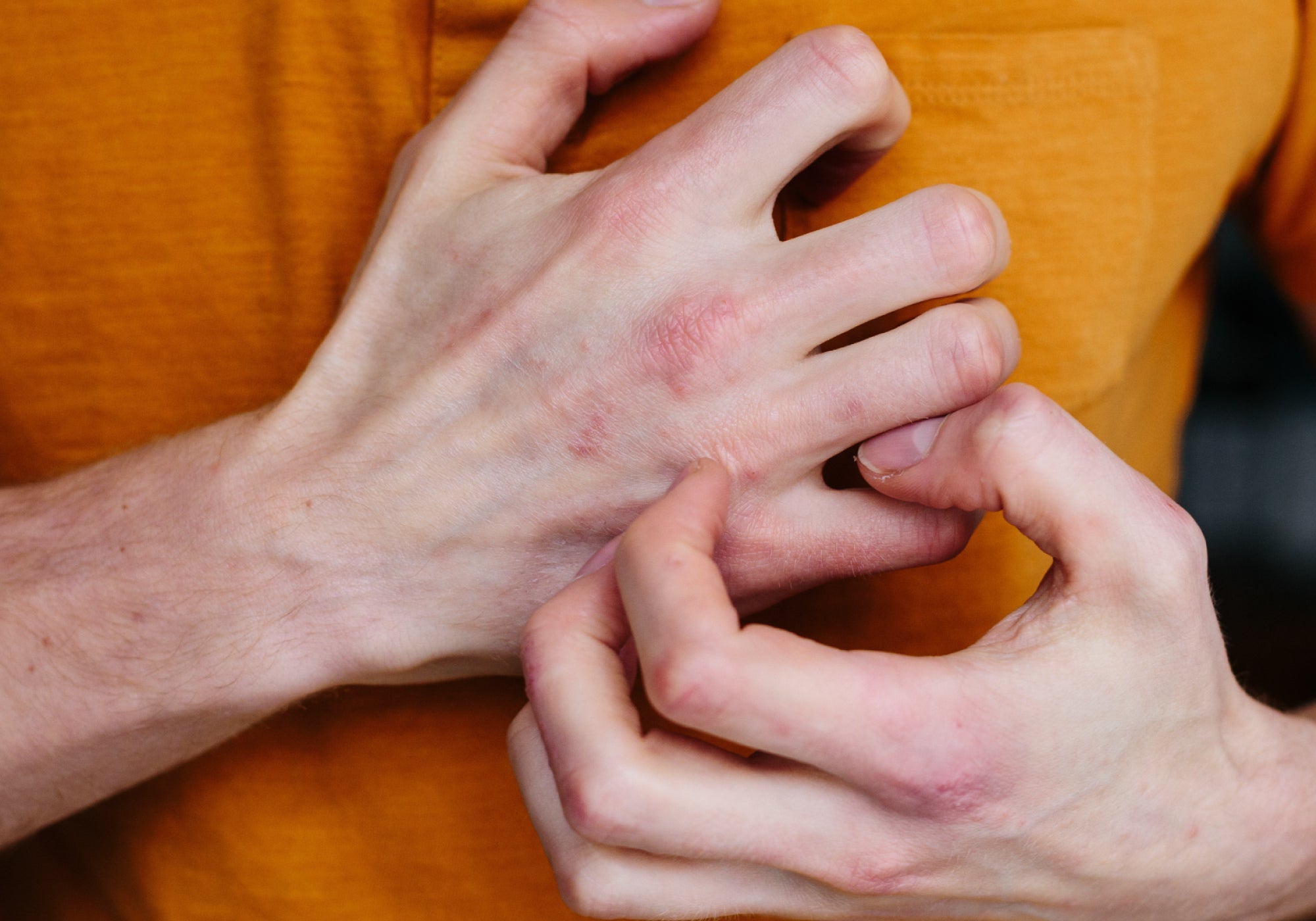 How To Soothe Sore Hands From Hand Washing