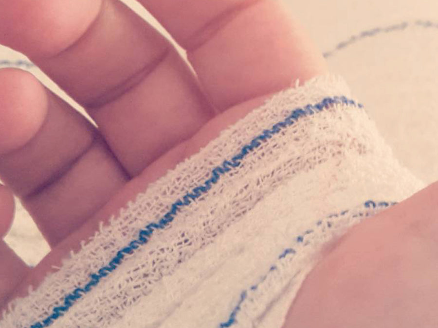 How To Wet Wrap Hand Eczema